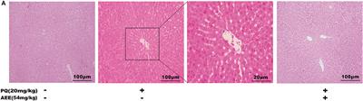 The Protective Effect of Aspirin Eugenol Ester on Paraquat-Induced Acute Liver Injury Rats